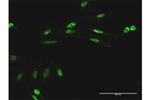 Immunofluorescence of purified MaxPab antibody to RIOK1 on HeLa cell. (RIOK1 antibody  (AA 1-568))