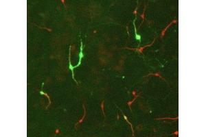 Immunostaining of E17 rat midbrain mixed neuronal cultures showing TH positive neurons in green and MAP2 (ABIN361345) in red. (Tyrosine Hydroxylase antibody)