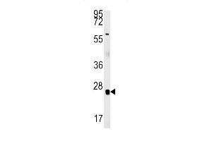 RBM24 Antibody (N-term) (ABIN651797 and ABIN2840402) western blot analysis in mouse heart tissue lysates (15 μg/lane). (RBM24 antibody  (N-Term))