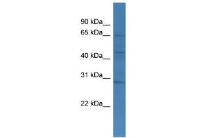 WB Suggested Anti-TMCO4 Antibody Titration: 0. (TMCO4 antibody  (C-Term))