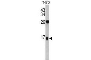 Image no. 1 for anti-Dermcidin (DCD) (C-Term) antibody (ABIN452901) (Dermcidin antibody  (C-Term))