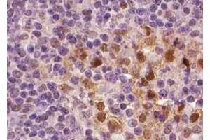 ABIN6267001 at 1/100 staining human Lymph node tissue sections by IHC-P.