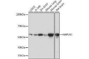 Western blot analysis of extracts of various cell lines, using H Rabbit mAb (ABIN7267797) at 1:1000 dilution. (HAPLN1 antibody)