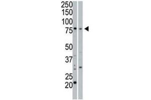 cGKI beta antibody used in western blot to detect cGKIbeta in 293 cell lysate (Lane 1) and mouse small intestine tissue lysate (2). (PRKG1 antibody  (AA 629-660))