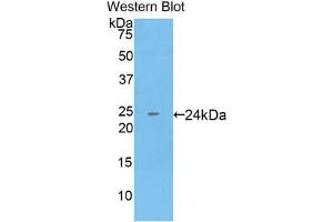 Detection of Recombinant KRT18, Human using Monoclonal Antibody to Cytokeratin 18 (CK18) (Cytokeratin 18 antibody  (AA 238-396))