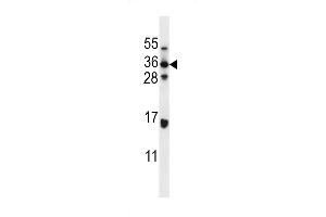 Western blot analysis in MDA-MB435 cell line lysates (35ug/lane). (ELOVL5 antibody  (C-Term))