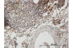 Immunoperoxidase of purified MaxPab antibody to SH3KBP1 on formalin-fixed paraffin-embedded human lymph node. (SH3KBP1 antibody  (AA 1-665))
