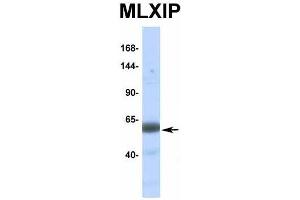 Host:  Rabbit  Target Name:  MLXIP  Sample Type:  Human Fetal Muscle  Antibody Dilution:  1. (MLXIP antibody  (Middle Region))