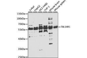 Western blot analysis of extracts of various cell lines, using TBL1XR1 antibody (ABIN6132718, ABIN6148894, ABIN6148896 and ABIN6223805) at 1:1000 dilution.