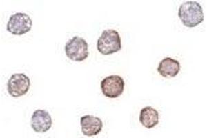 Immunocytochemistry of Actin in HeLa cells with AP30139PU-N Actin antibody at 2 μg/ml.