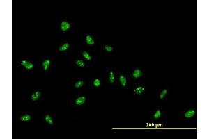 Immunofluorescence of purified MaxPab antibody to ZNF593 on HeLa cell. (ZNF593 antibody  (AA 1-116))