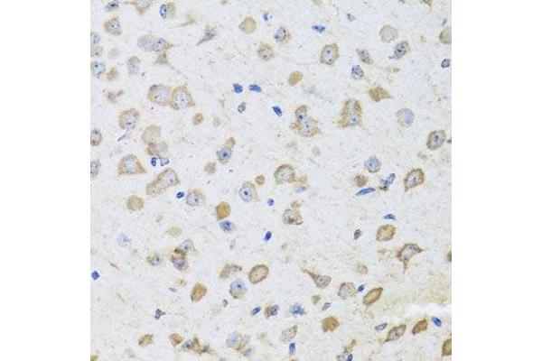ARL6 antibody  (AA 1-186)