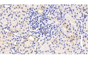 Detection of SPINK5 in Human Kidney Tissue using Polyclonal Antibody to Serine Peptidase Inhibitor Kazal Type 5 (SPINK5) (SPINK5 antibody  (AA 699-976))