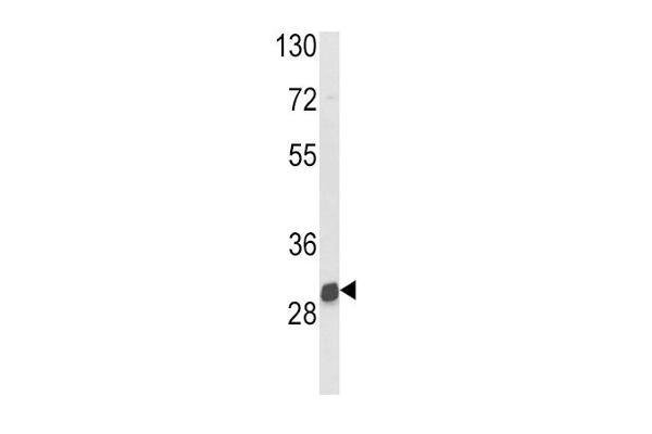 NAT2 antibody  (C-Term)