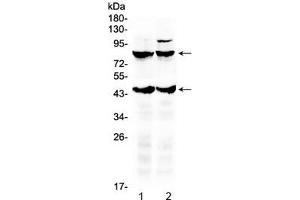 Western blot testing of 1) rat brain and 2) mouse brain lysate with TSH Receptor antibody. (TSHR, B Chain antibody  (AA 515-538))