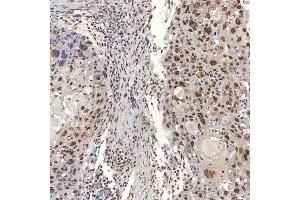IHC analysis of U1A/SNRPA using anti-U1A/SNRPA antibody (ABIN7600891). (SNRPA1 antibody  (AA 25-218))