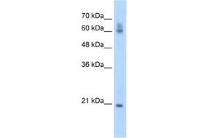 Western Blotting (WB) image for anti-FIP1 Like 1 (FIP1L1) antibody (ABIN2462308) (FIP1L1 antibody)