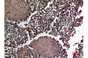 Immunohistochemistry (IHC) image for anti-HSPB (Heat Shock 27kDa) Associated Protein 1 (HSPBAP1) (Internal Region) antibody (ABIN6283284)