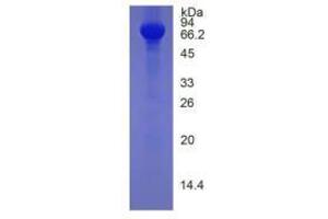 Image no. 1 for Histidine-Rich Glycoprotein (HRG) (AA 19-525) (Active) protein (His tag) (ABIN5665813) (HRG Protein (AA 19-525) (His tag))