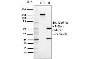 SDS-PAGE Analysis Purified FOXP3 Monoclonal Antibody (FXP3/197). (FOXP3 antibody)