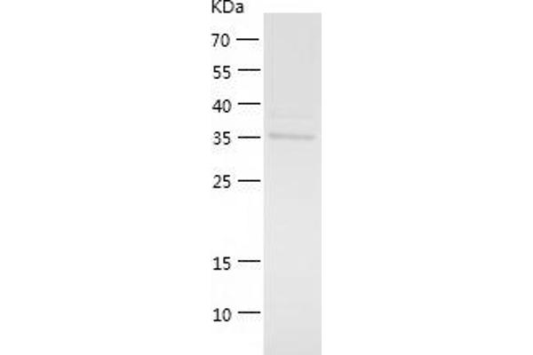 ROCK1 Protein (AA 317-627) (His tag)