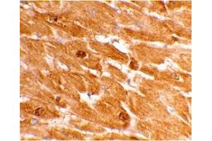 Immunohistochemistry (IHC) image for anti-Caspase 12 (Gene/pseudogene) (CASP12) (Large Isoform) antibody (ABIN1031699) (Caspase 12 antibody  (Large Isoform))