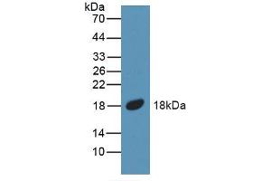 Figure. (BMP5 antibody  (AA 315-452))