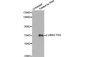 Western blot analysis of extracts from Hela cells, using Phospho-LIMK2-T505 antibody. (LIMK2 antibody  (pThr505))