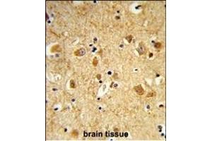 Formalin-fixed and paraffin-embedded human brain tissue reacted with DNM3 Antibody (Center), which was peroxidase-conjugated to the secondary antibody, followed by DAB staining. (Dynamin 3 antibody  (AA 557-584))