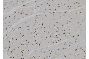 ABIN6276928 at 1/100 staining Rat heart tissue by IHC-P.