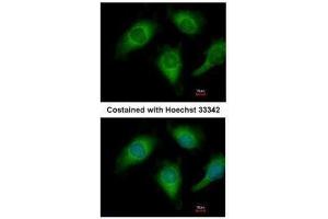 ICC/IF Image Immunofluorescence analysis of methanol-fixed HeLa, using Annexin A4, antibody at 1:200 dilution. (Annexin IV antibody)