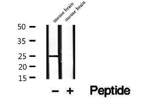 RAB3A antibody  (N-Term)