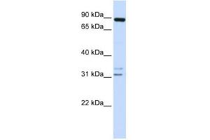 ADAM19 antibody used at 1 ug/ml to detect target protein. (ADAM19 antibody)