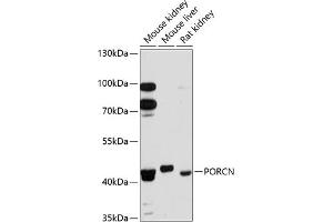 Western blot analysis of extracts of various cell lines, using PORCN antibody (ABIN6131340, ABIN6145972, ABIN6145974 and ABIN6215858) at 1:3000 dilution. (PORCN antibody  (AA 220-320))