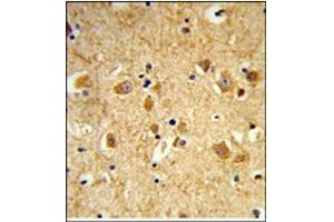 AP17991PU-N Dynamin-3 antibody staining of Formalin-Fixed, Paraffin-Embedded Human brain using Peroxidase-conjugated to the secondary antibody, followed by DAB staining. (Dynamin 3 antibody  (Middle Region))