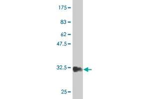 Western Blot detection against Immunogen (34. (HAND2 antibody  (AA 135-216))