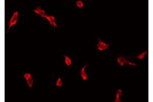 ABIN6272287 staining COLO205 by IF/ICC. (ZDHHC9 antibody  (C-Term))