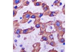Immunohistochemistry (IHC) image for anti-Ribosomal Protein L14 (RPL14) antibody (ABIN7308284) (RPL14 antibody)