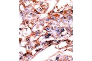 Image no. 2 for anti-V-Erb-A erythroblastic Leukemia Viral Oncogene Homolog 4 (Avian) (ERBB4) (pTyr1188) antibody (ABIN358140) (ERBB4 antibody  (pTyr1188))