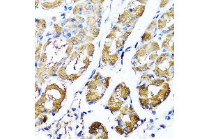 Immunohistochemistry of paraffin-embedded human stomach using HY antibody  at dilution of 1:100 (40x lens). (HYAL1 antibody  (AA 136-435))