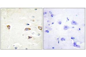 Immunohistochemistry (IHC) image for anti-CDC42 Binding Protein Kinase beta (DMPK-Like) (CDC42BPB) (C-Term) antibody (ABIN1850128)