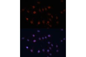 Immunofluorescence analysis of C6 cells using TOM70 antibody (ABIN1683089, ABIN3018839, ABIN3018840 and ABIN6220597) at dilution of 1:100. (TOM70 antibody  (AA 60-340))