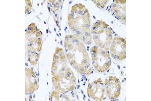 Immunohistochemistry of paraffin-embedded human gastric using CBR4 antibody at dilution of 1:100 (x40 lens).