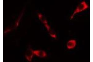 ABIN6276324 staining HeLa cells by IF/ICC. (KRT20 antibody  (C-Term))