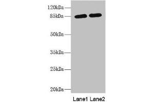 Western blot All lanes: MAGED1 antibody at 5. (MAGED1 antibody  (AA 579-778))