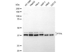 Western blotting analysis using PTPA antibody (ABIN7800025).