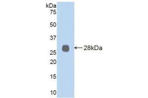 Western blot analysis of recombinant Human LOXL2. (LOXL2 antibody  (AA 544-751))
