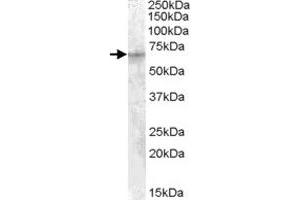 IGF2BP2 polyclonal antibody  (1 ug/mL) staining of HepG2 cell lysate (35 ug protein in RIPA buffer). (IGF2BP2 antibody)