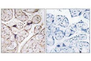 Immunohistochemistry (IHC) image for anti-Alkaline Ceramidase 3 (ACER3) (Internal Region) antibody (ABIN1850730) (ACER3 antibody  (Internal Region))