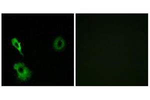 Immunofluorescence analysis of A549 cells, using GRM7 antibody. (GRM7 antibody  (Internal Region))